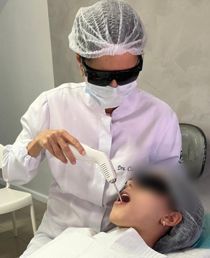 Laserterapia no tratamento de aftas